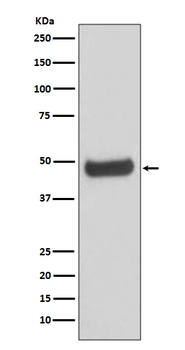 PKA 2 beta Rabbit mAb Antibody