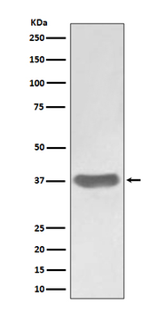 SFRP1 Rabbit mAb Antibody