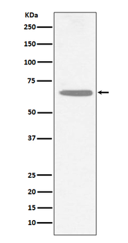 CHAT Rabbit mAb Antibody