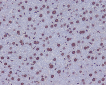 53BP1 Rabbit mAb Antibody