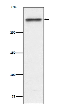 53BP1 Rabbit mAb Antibody
