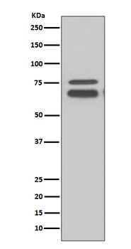 FMRP Rabbit mAb Antibody