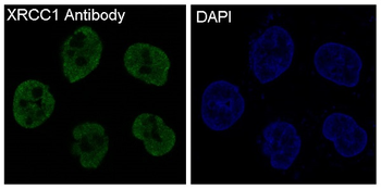 XRCC1 Rabbit mAb Antibody