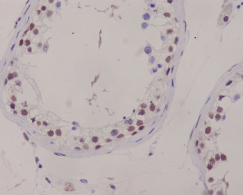 XRCC1 Rabbit mAb Antibody