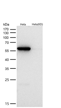 Calcineurin A Rabbit mAb [KD Validated] Antibody