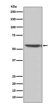 Calcineurin A Rabbit mAb [KD Validated] Antibody