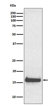 TTR Rabbit mAb Antibody