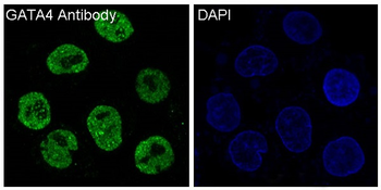 GATA4 Rabbit mAb Antibody
