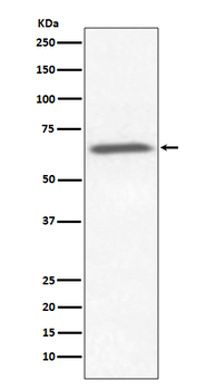 Ku70 Rabbit mAb [KD Validated]