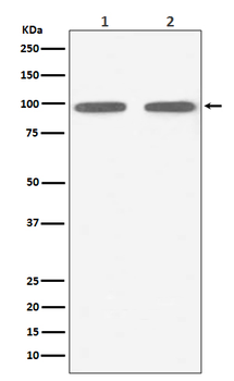 FGFR3 Rabbit mAb Antibody