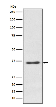 Syndecan 1 Rabbit mAb Antibody