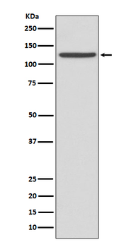 CD41 Rabbit Monoclonal Antibody