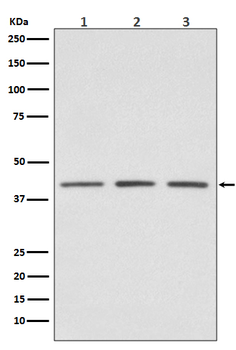 PRMT1 Rabbit mAb Antibody