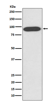 VCP Rabbit mAb Antibody