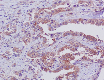 Bid Rabbit mAb