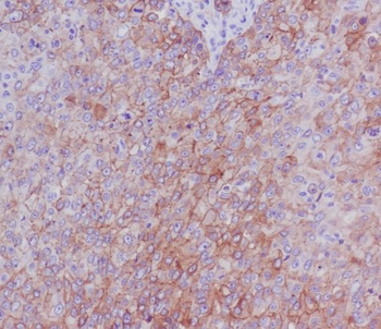 Integrin beta 4 Rabbit Monoclonal Antibody