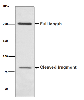 L1CAM Rabbit mAb Antibody