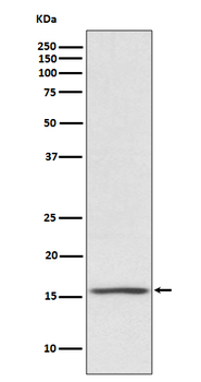 Noxa Rabbit mAb Antibody