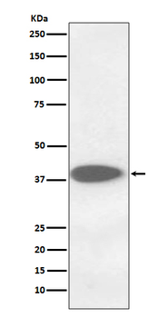 Cathepsin B Rabbit mAb Antibody