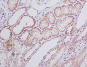 BNIP3 Rabbit mAb Antibody