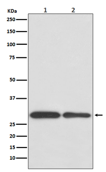 BNIP3 Rabbit mAb Antibody