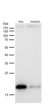 VAMP2 Rabbit mAb [KD Validated] Antibody