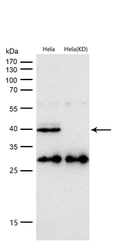 AQP1 Rabbit mAb [KD Validated] Antibody