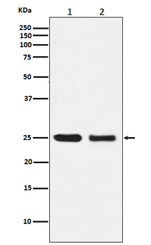AQP1 Rabbit mAb [KD Validated] Antibody