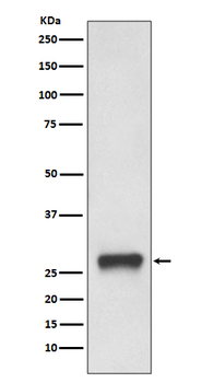 MHC Class II Rabbit mAb Antibody
