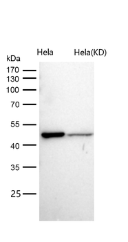ATPB Rabbit mAb [KD Validated] Antibody