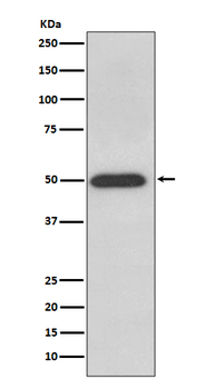 ATPB Rabbit mAb [KD Validated] Antibody