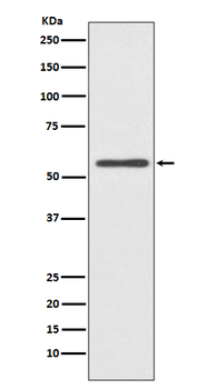 CYP2E1 Rabbit Monoclonal Antibody