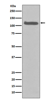 FGFR3 Rabbit mAb Antibody