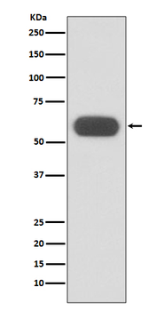 GBA Rabbit mAb Antibody