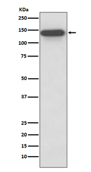 SMC3 Rabbit mAb Antibody