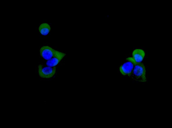 CD59 Rabbit mAb Antibody