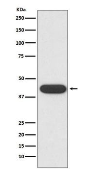 CD32 Rabbit Monoclonal Antibody