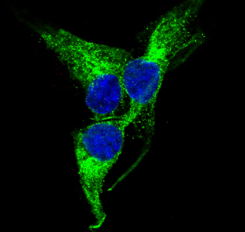 PGP9.5 Rabbit mAb Antibody