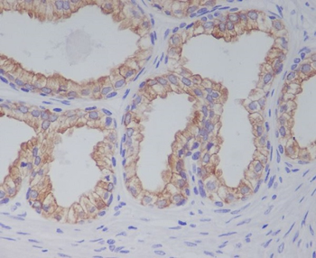 PGP9.5 Rabbit mAb
