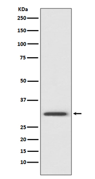 Annexin V Rabbit mAb [KD Validated] Antibody