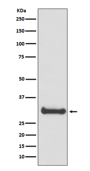 Calbindin Rabbit mAb Antibody