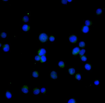 Bcl-2 Rabbit mAb Antibody
