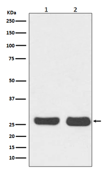 Bcl-2 Rabbit mAb Antibody