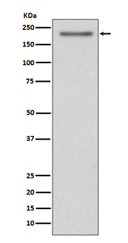 PDGFR alpha Rabbit mAb Antibody