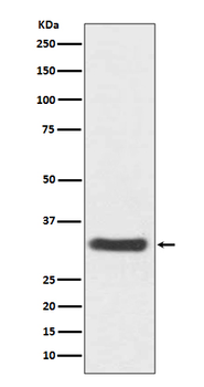 NQO1 Rabbit mAb Antibody