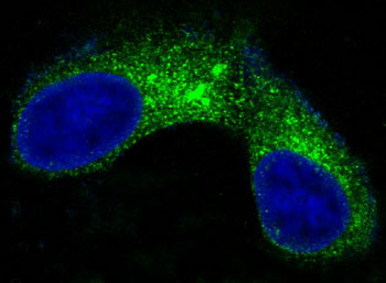 CEA(CD66e) Rabbit mAb Antibody