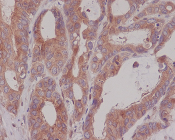 CEA(CD66e) Rabbit mAb Antibody