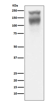 CEA(CD66e) Rabbit mAb Antibody