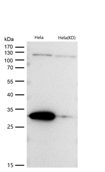 Galectin 3 Rabbit mAb [KD Validated]