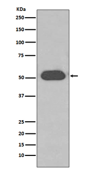 GC / VDBP Rabbit mAb Antibody